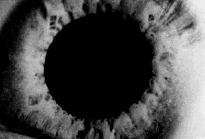 “Tengo un sucio pegado al lente de contacto, pero puedo vivir con eso perfectamente”. | 15 Frases que nunca en la vida le oirás decir a una persona miope